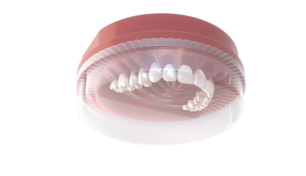 Ivotion-Disc-showing-Teeth-in-position