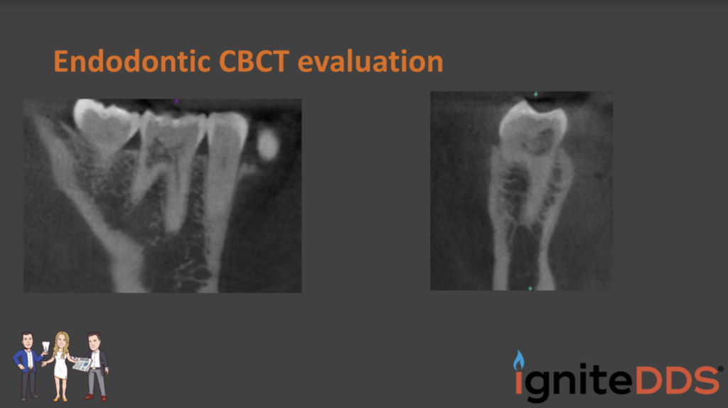 endodontic cbct evaluation