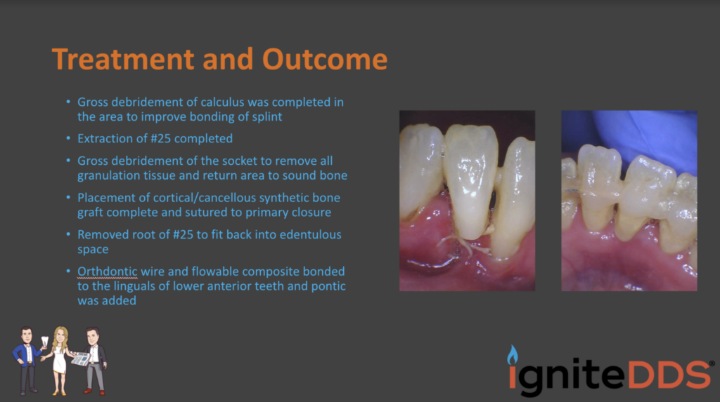 periodontal infection treatment outcome