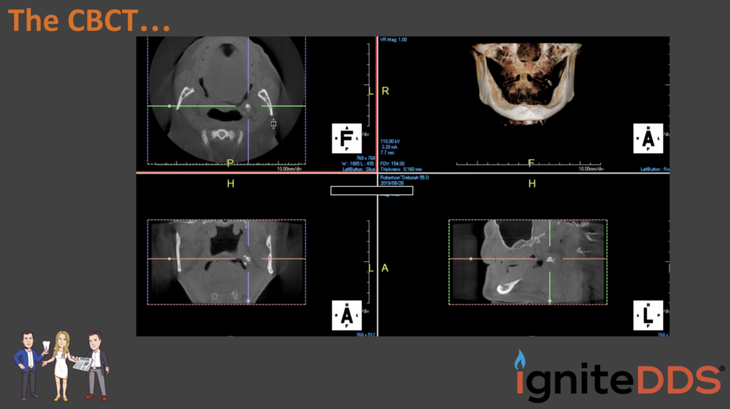 the-cbct