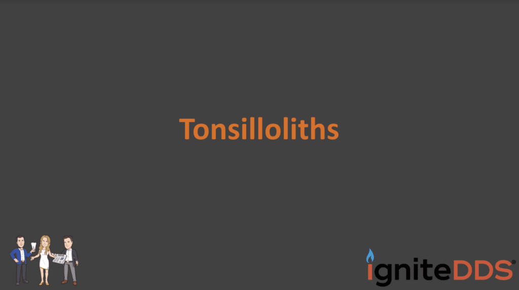 Tonsilloliths, or tonsil stones