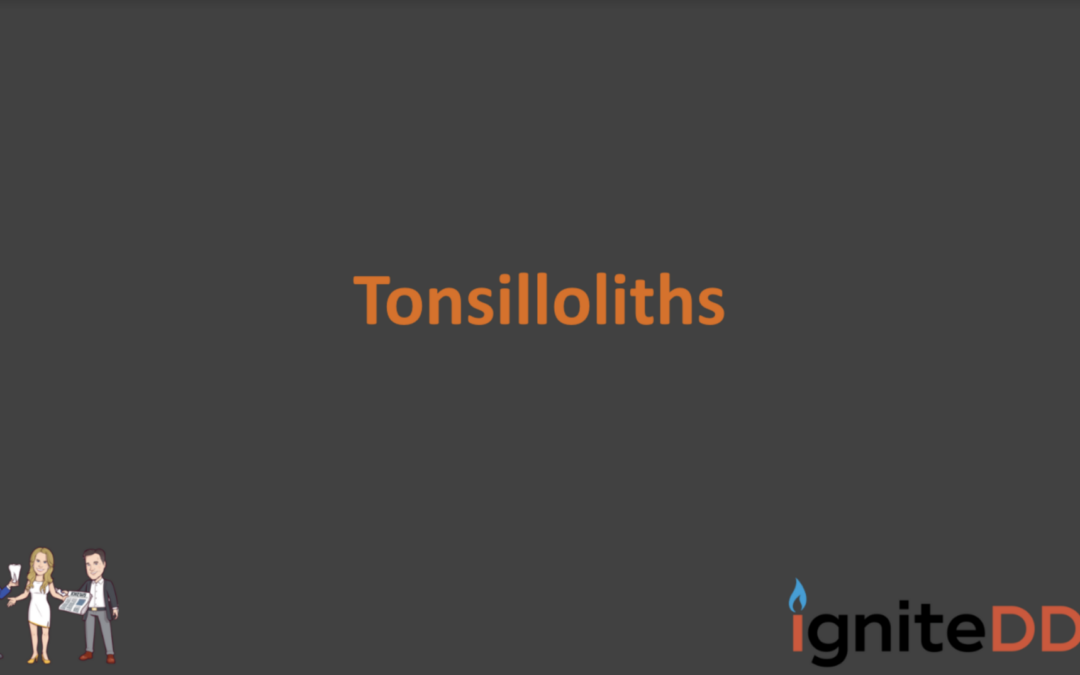Tonsilloliths: Case Study