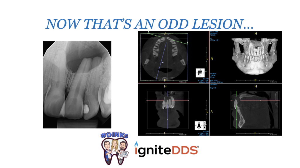 dealing with an odd dental lesion