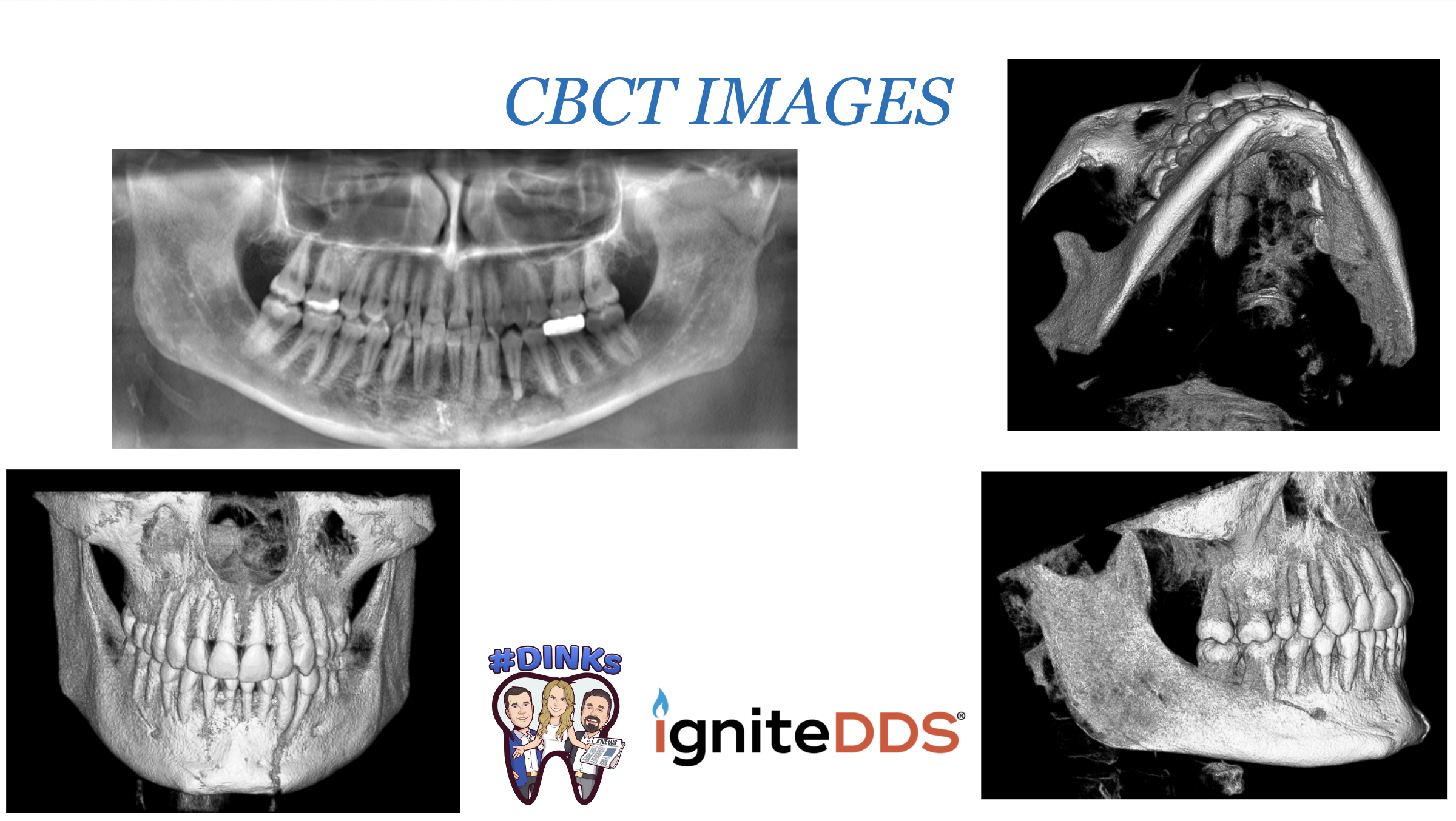 cbct images