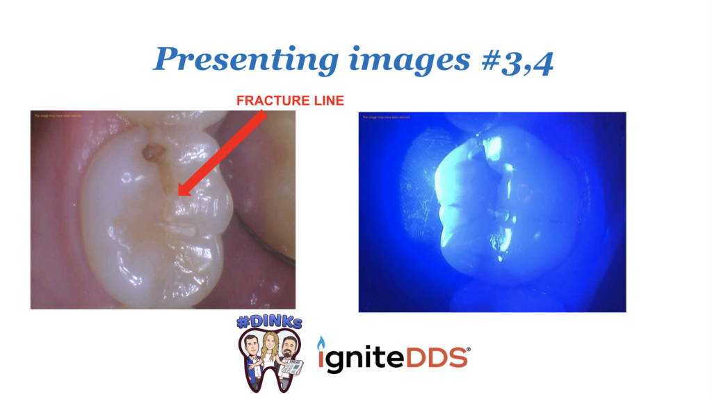 images of tooth that is not hurting