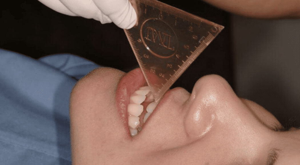 An Occlusion-Focused Hygiene Exam An Occlusion-Focused Hygiene Exam