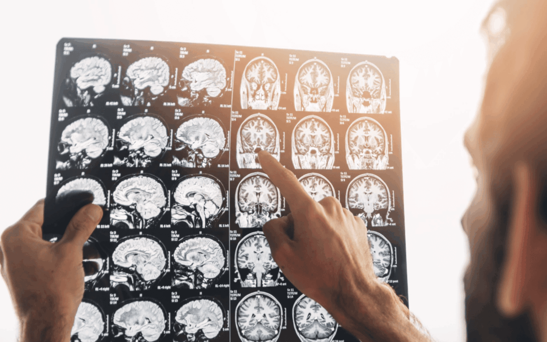 What Script Do I Need To Order an MRI for a Patient?