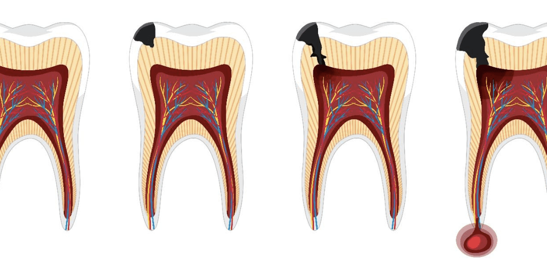 Medications that Interfere with Accurate Endodontic Diagnosis