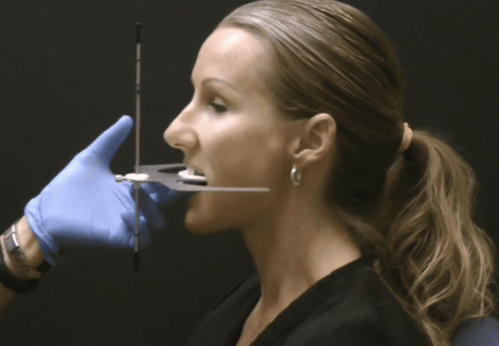 mastering panadent dento facial analyzer technique