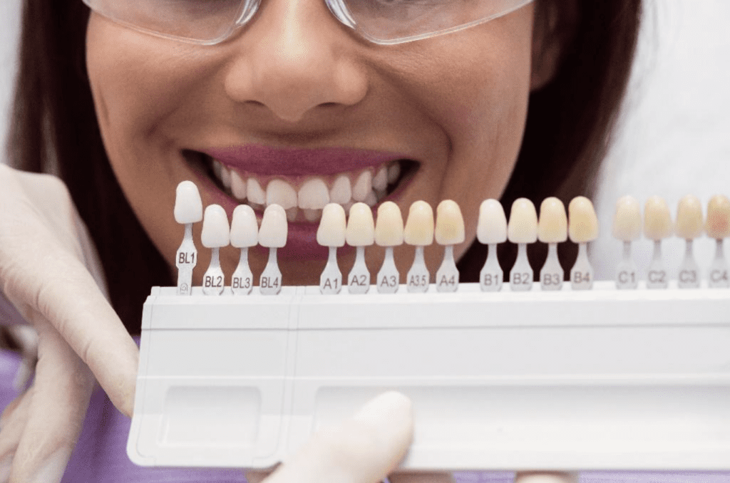 Achieving the Ideal Shade for Complex Restorative Cases