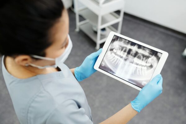 class III cavity guide for dental students