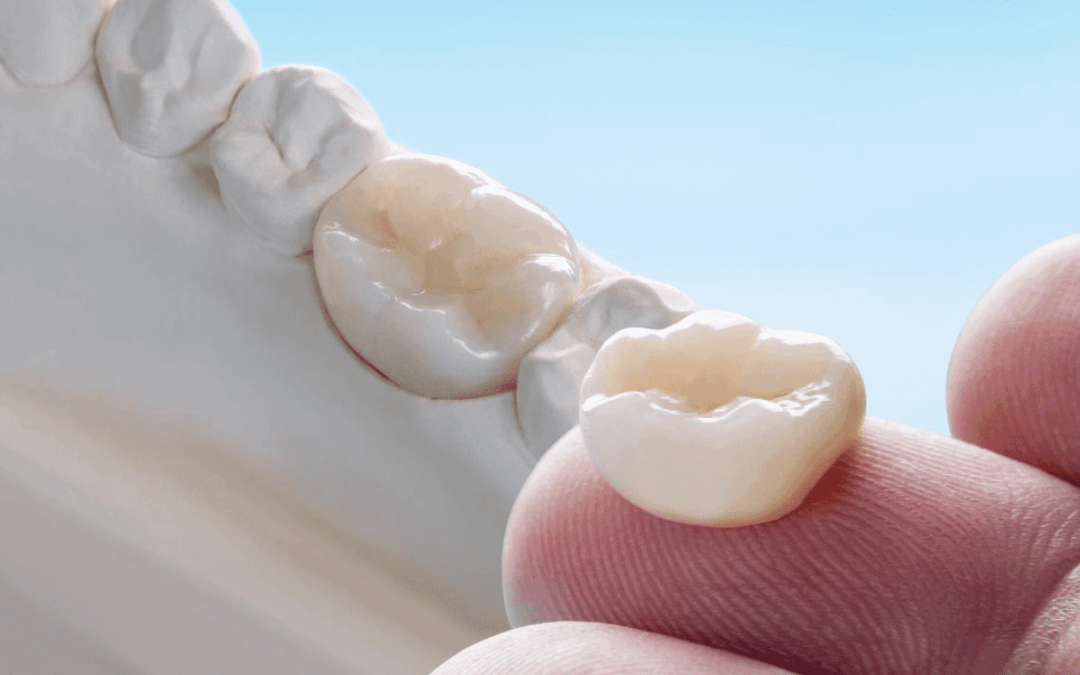 Making Informed Decisions When Choosing Zirconia Restorations