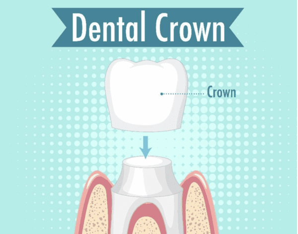 Removing Dental Cement Inside A Zirconia And Lithium Disilicate Crown