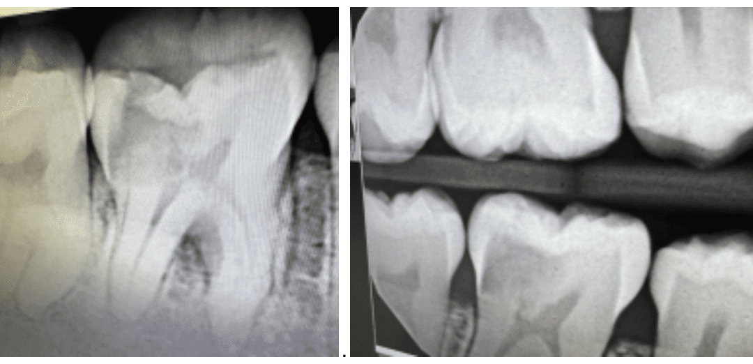 Clinical Based Case As A D4 Student