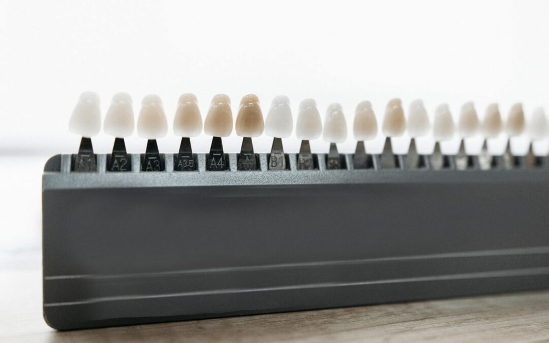 Mistakes I Learned from Doing Composite Veneers
