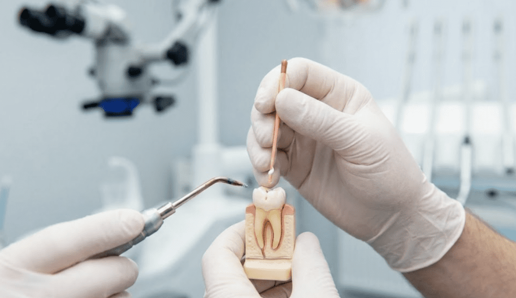 endo made simple part 3 obturation