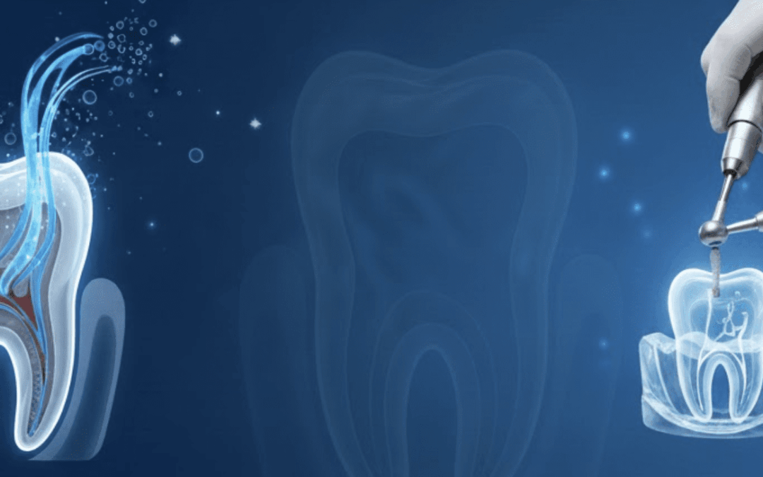 Endo Made Simple Part 2: Shaping, Cleaning, & Irrigation