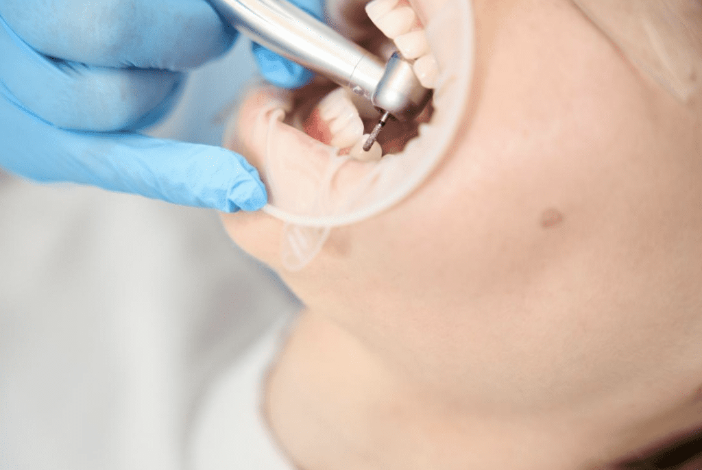 evaluating crown integrity