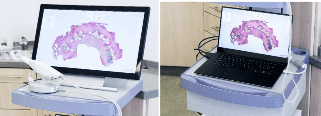 limitations of digital dentistry when technology falls short