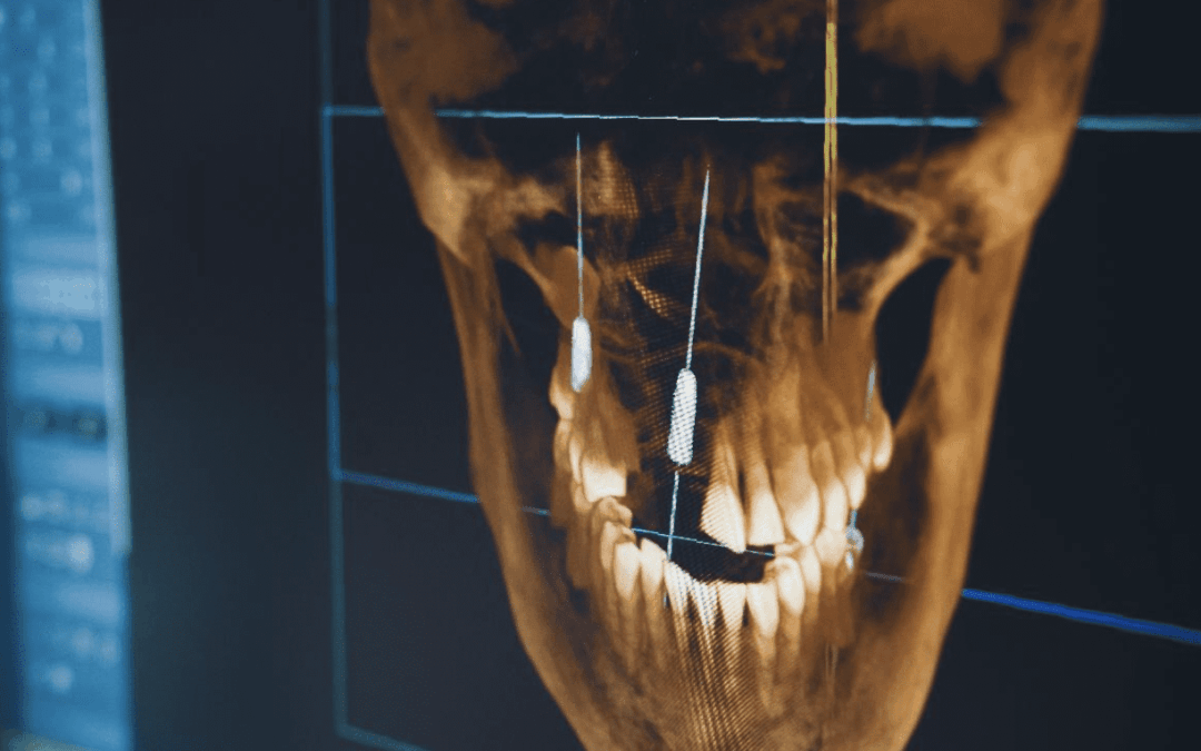 Advancing Implant Dentistry Through Digital Precision