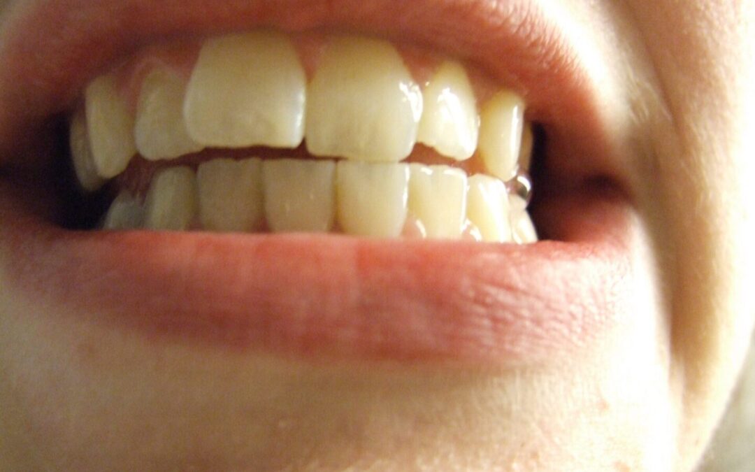 Here’s the Key to Explaining the Oral-Systemic Link