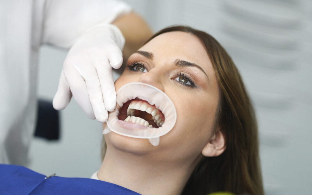 Feel the Difference of Innovation: OptraGate® 2 Brings Comfort and Efficiency to the Dental Practice