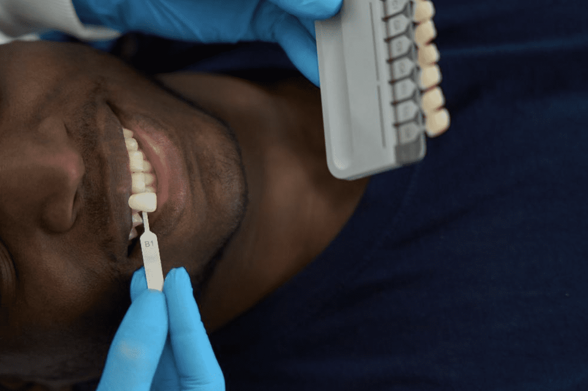 A-Conservative-Approach-for-Missing-Lateral-Incisors