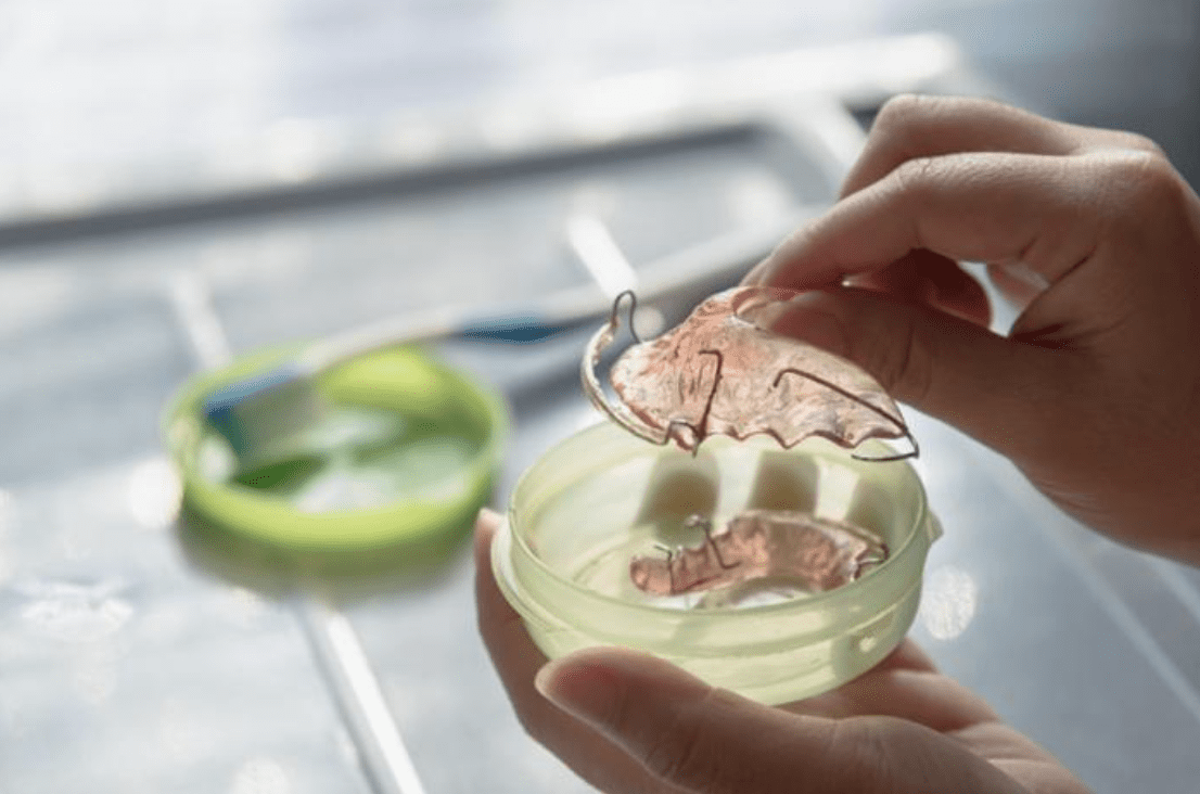 A-Dentists-Perspective-on-Retainer-Wear-Time
