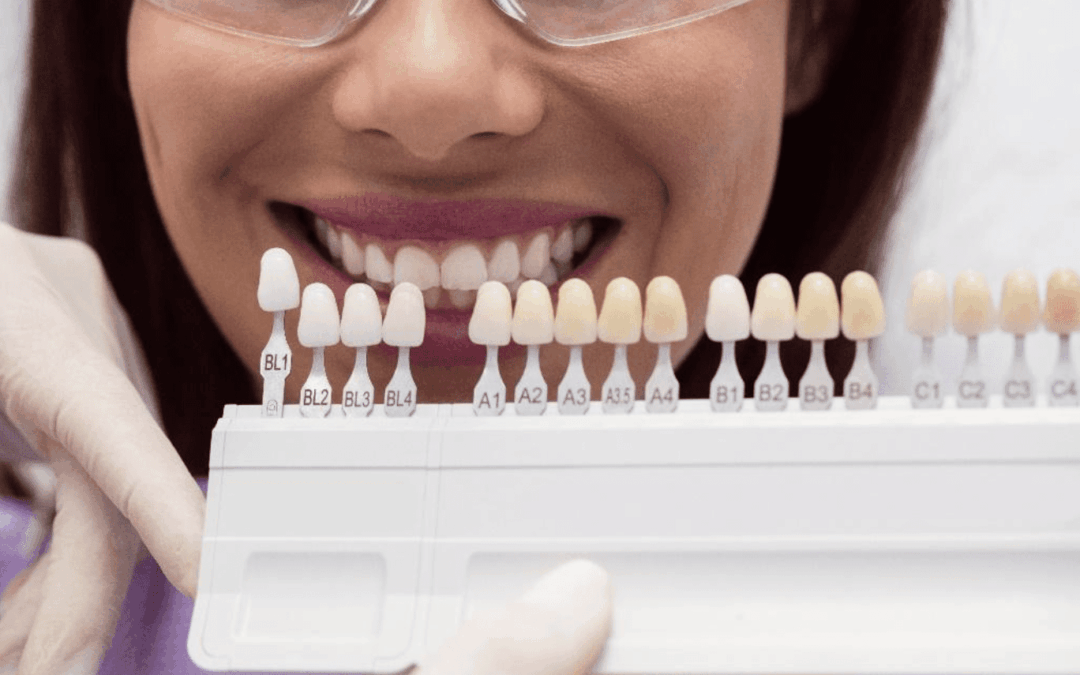 Achieving the Ideal Shade for Complex Restorative Cases