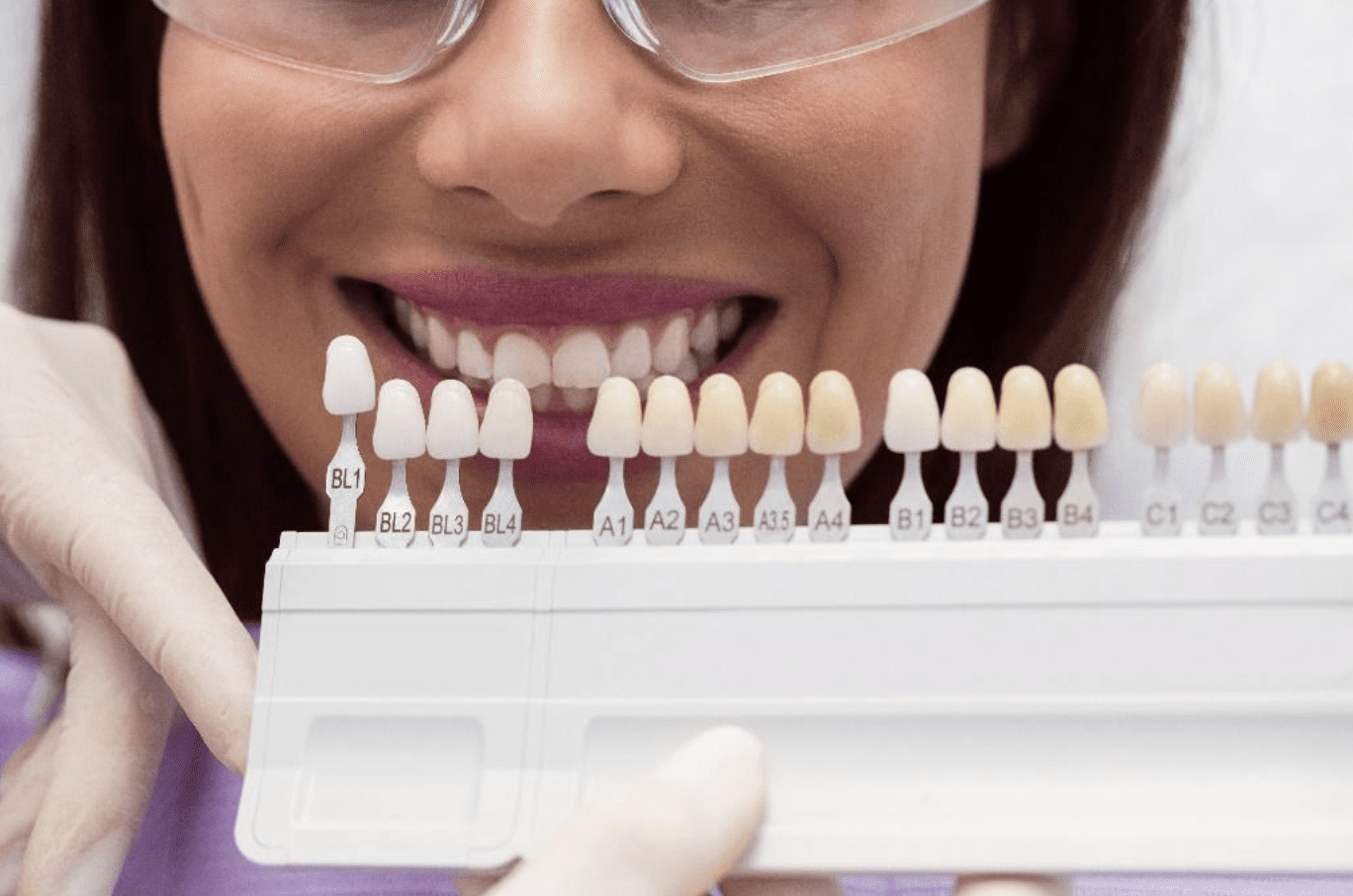 Achieving-the-Ideal-Shade-for-Complex-Restorative-Cases