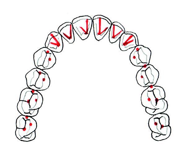 How-Does-the-Occlusal-Plane-Relate-to-the-Anterior-Teeth-The-Dawson-Academy