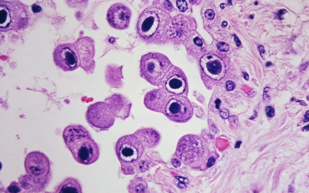 Infection control: How NOT to get sued … and a whole lot more
