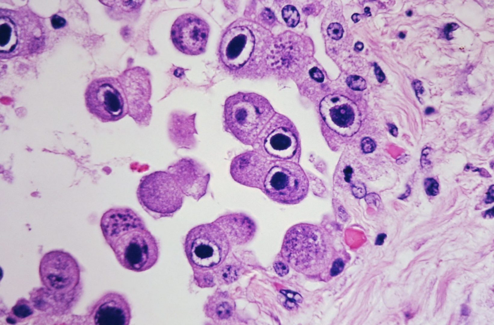 Infection-scaled