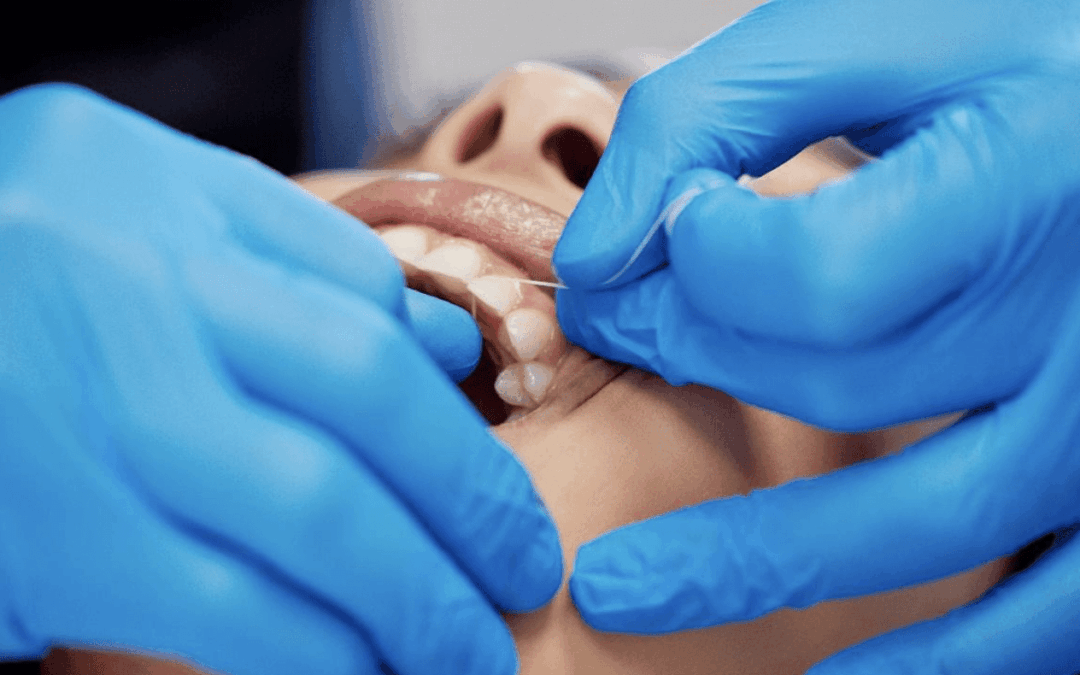 Preventing Tooth Wear and Color Loss When Adjusting Zirconia