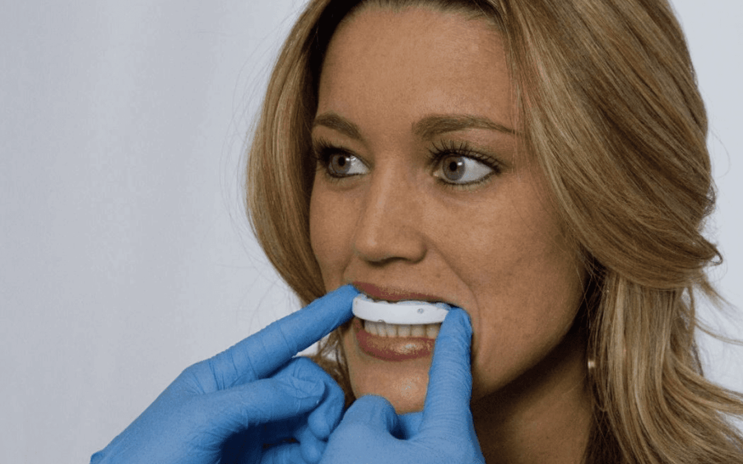 QuickSplint: Predictable Diagnostics and Restorative Success