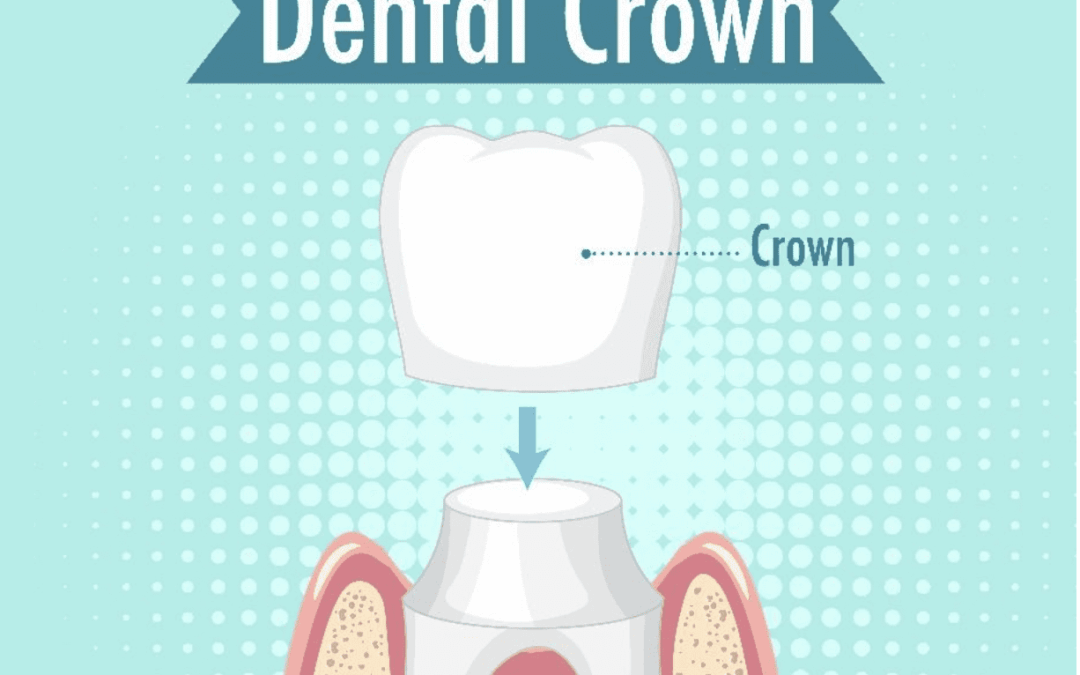 Removing Dental Cement Inside A Zirconia And Lithium Disilicate Crown