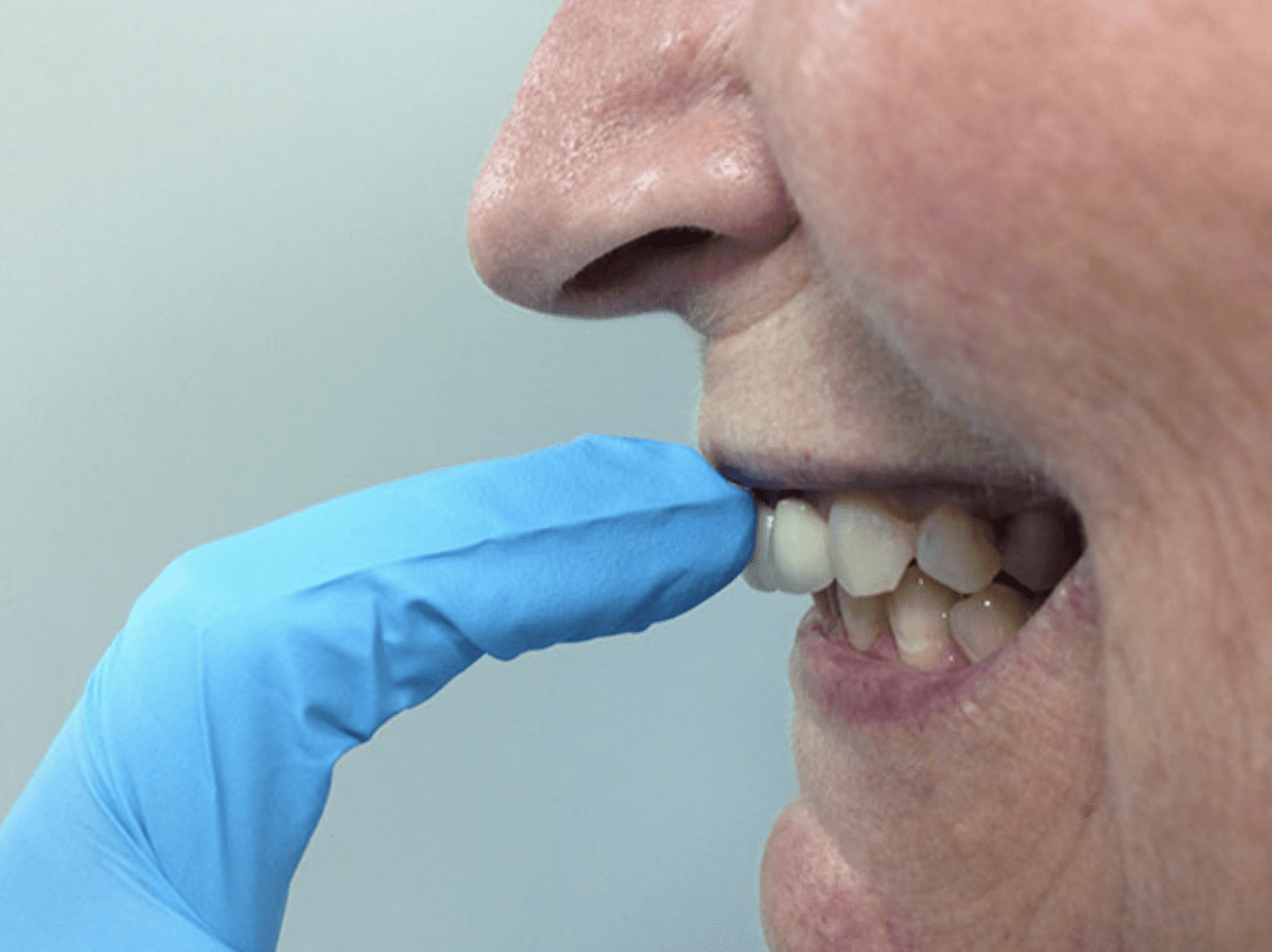 dentist-checking-patient-for-fremitus