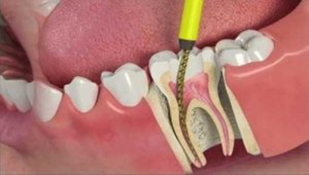 general-dentist-or-specialize