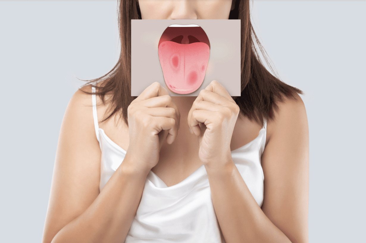 hpv-and-oral-cancer-patient