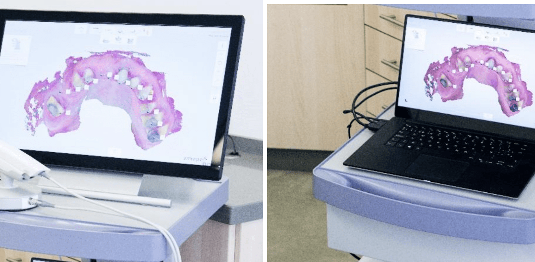Limitations of Digital Dentistry: When Technology Falls Short