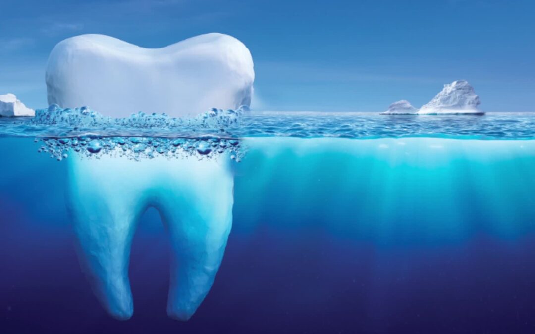 Best Type of Fluoride Toothpaste for Gum Health