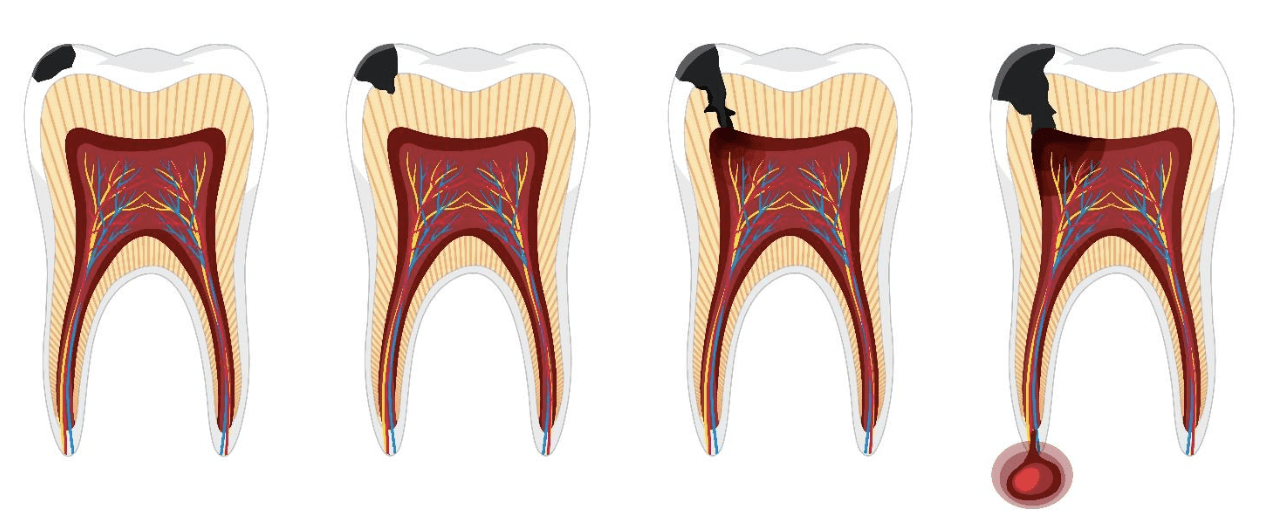 medications-that-interfere-with-accurate-endodontic-diagnosis