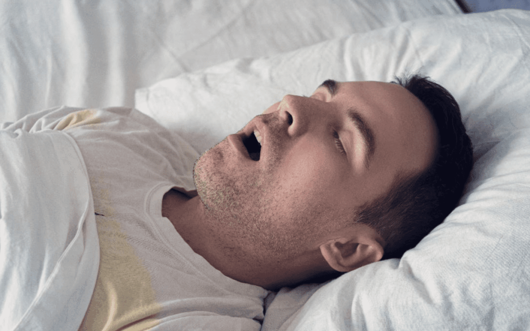 Oral Appliance Therapy for Sleep-Disordered Breathing