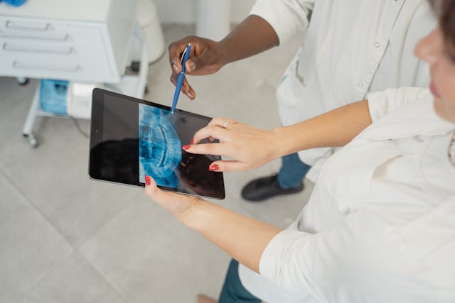 overlapping-of-dental-x-rays