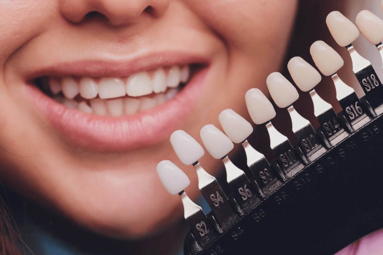 tips-to-ensure-precision-in-veneer-preparation
