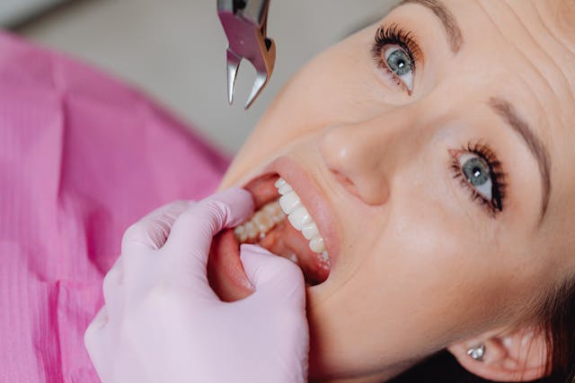 tooth-extractions