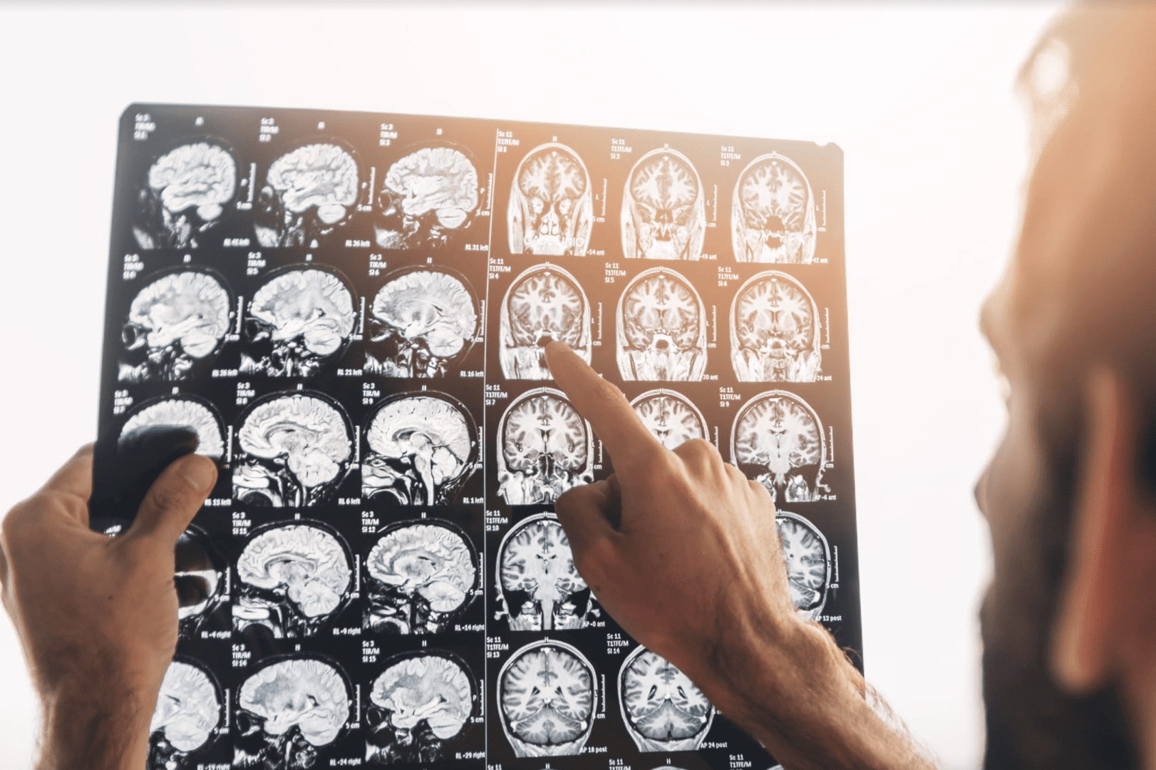 what-script-do-i-need-to-order-an-mri-for-a-patient