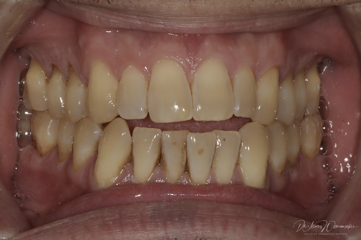 The Role of Orthodontics in Cosmetic Dentistry