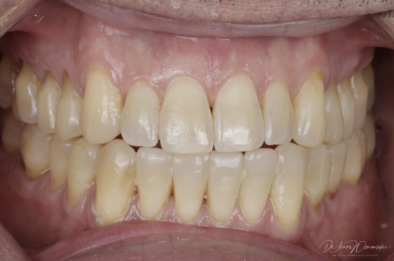 treatment sequence matters