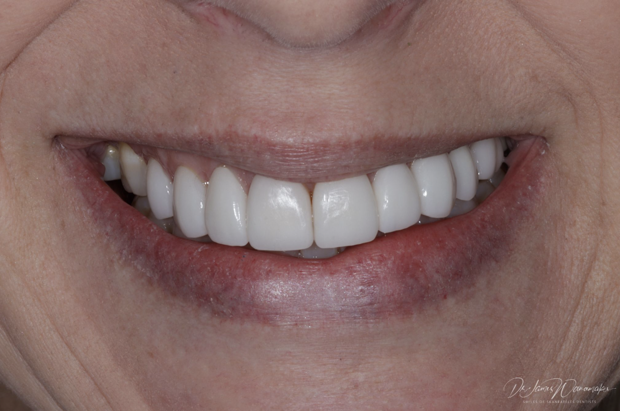 cosmetic dentistry photo 1
